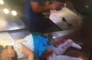 爆料女孩截肢视频播放全集,爆料女孩勇敢讲述心酸历程